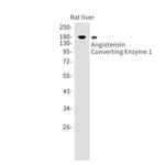 ACE Antibody in Western Blot (WB)