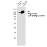 ACE Recombinant Rabbit Monoclonal Antibody (K01_1M75)