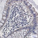 ALDH2 Recombinant Rabbit Monoclonal Antibody (K01_1M53)