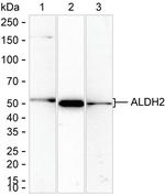 ALDH2 Antibody in Western Blot (WB)