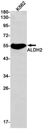 ALDH2 Antibody in Western Blot (WB)