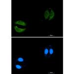 RAB5C Recombinant Rabbit Monoclonal Antibody (K01_1K96)