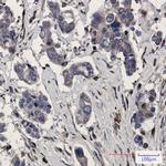 RAB5C Antibody in Immunohistochemistry (Paraffin) (IHC (P))