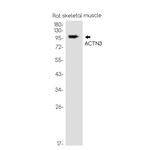 alpha Actinin 3 Recombinant Rabbit Monoclonal Antibody (K01_1M38)