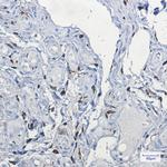 Factor XIII Recombinant Rabbit Monoclonal Antibody (K01_1K61)