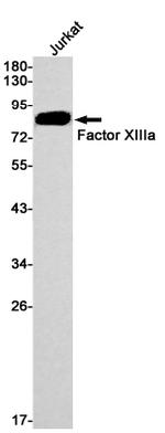 Factor XIII Antibody in Western Blot (WB)