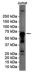 ATF2 Antibody in Western Blot (WB)