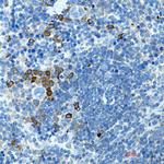 BTLA Recombinant Rabbit Monoclonal Antibody (K01_1P14)