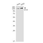 MLLT10 Recombinant Rabbit Monoclonal Antibody (K01_1M47)