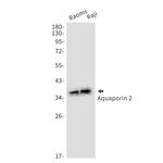 Aquaporin 2 Recombinant Rabbit Monoclonal Antibody (K01_1M97)