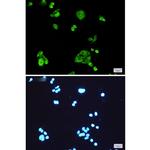 PGD Recombinant Rabbit Monoclonal Antibody (K01_1K97)