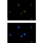 PAK1 Recombinant Rabbit Monoclonal Antibody (K01_1W34)