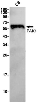PAK1 Antibody in Western Blot (WB)