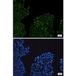 HADHA Recombinant Rabbit Monoclonal Antibody (K01_1S01)