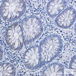 HADHA Antibody in Immunohistochemistry (Paraffin) (IHC (P))