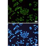 STAT5 alpha Recombinant Rabbit Monoclonal Antibody (K01_1Y78)