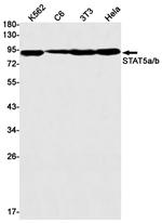 STAT5 alpha Antibody in Western Blot (WB)