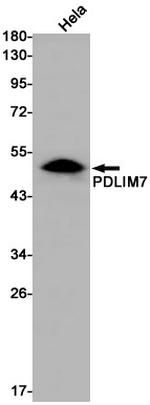 PDLIM7 Recombinant Rabbit Monoclonal Antibody (K01_1W53)