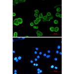 P-cadherin Recombinant Rabbit Monoclonal Antibody (K01_1W36)