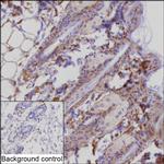 P-cadherin Antibody in Immunohistochemistry (Paraffin) (IHC (P))