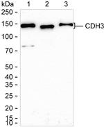 P-cadherin Antibody in Western Blot (WB)