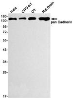 P-cadherin Antibody in Western Blot (WB)