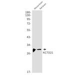 KCTD21 Recombinant Rabbit Monoclonal Antibody (K01_1T21)