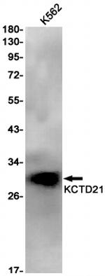 KCTD21 Antibody in Western Blot (WB)