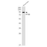 IFT88 Antibody in Western Blot (WB)