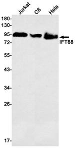 IFT88 Recombinant Rabbit Monoclonal Antibody (K01_1S70)