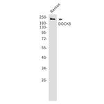 DOCK8 Recombinant Rabbit Monoclonal Antibody (K01_1Q53)