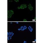 PGM1 Recombinant Rabbit Monoclonal Antibody (K01_1W67)