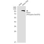 Phospho-PRKD2 (Ser876) Recombinant Rabbit Monoclonal Antibody (K01_1W87)