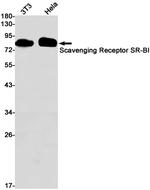 SR-BI Recombinant Rabbit Monoclonal Antibody (K01_1Y13)