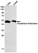 GSR Recombinant Rabbit Monoclonal Antibody (K01_1R75)