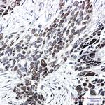 TCF7L2 Recombinant Rabbit Monoclonal Antibody (K01_2J14)