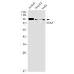 NEK4 Recombinant Rabbit Monoclonal Antibody (K01_1U62)