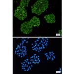 MARS Recombinant Rabbit Monoclonal Antibody (K01_1T64)