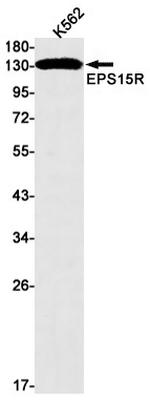 EPS15R Recombinant Rabbit Monoclonal Antibody (K01_1Q86)