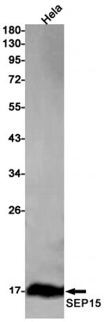 SEP15 Recombinant Rabbit Monoclonal Antibody (K01_1Y24)