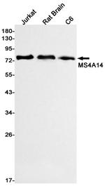 MS4A14 Recombinant Rabbit Monoclonal Antibody (K01_1U10)