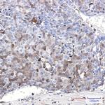 CDKN2C Recombinant Rabbit Monoclonal Antibody (K01_1W15)