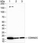 CDKN2C Antibody in Western Blot (WB)