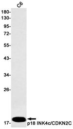 CDKN2C Antibody in Western Blot (WB)