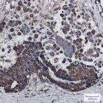 MDH2 Recombinant Rabbit Monoclonal Antibody (K01_1T72)