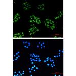 NDUFB10 Recombinant Rabbit Monoclonal Antibody (K01_1U51)