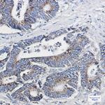 NDUFB10 Antibody in Immunohistochemistry (Paraffin) (IHC (P))