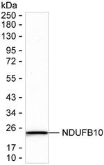 NDUFB10 Antibody in Western Blot (WB)