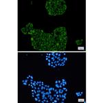 PFKP Antibody in Immunocytochemistry (ICC/IF)