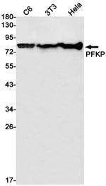 PFKP Antibody in Western Blot (WB)